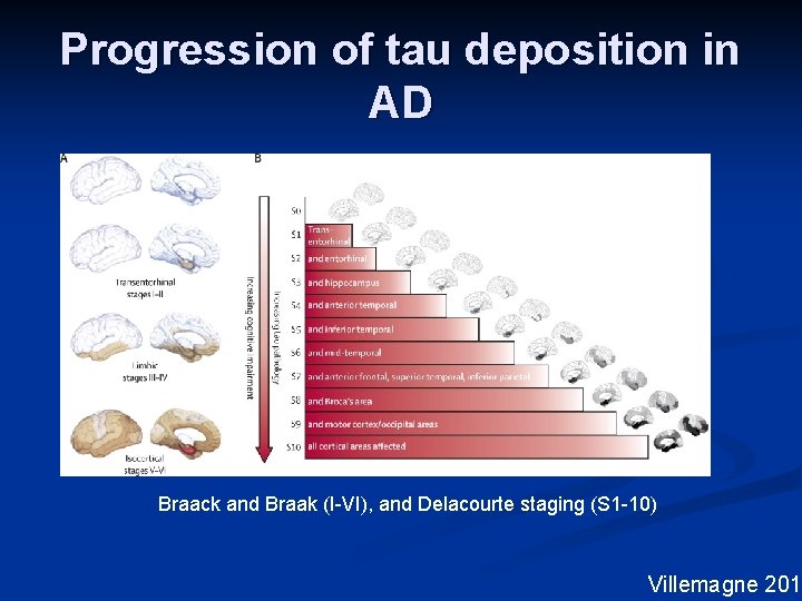 Progression of tau deposition in AD Braack and Braak (I-VI), and Delacourte staging (S