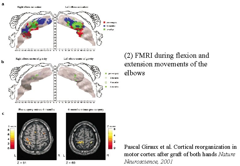  (2) FMRI during flexion and extension movements of the elbows Pascal Giraux et