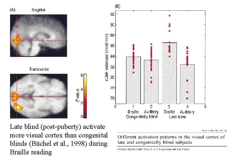 Late blind (post-puberty) activate more visual cortex than congenital blinds (Büchel et al. ,