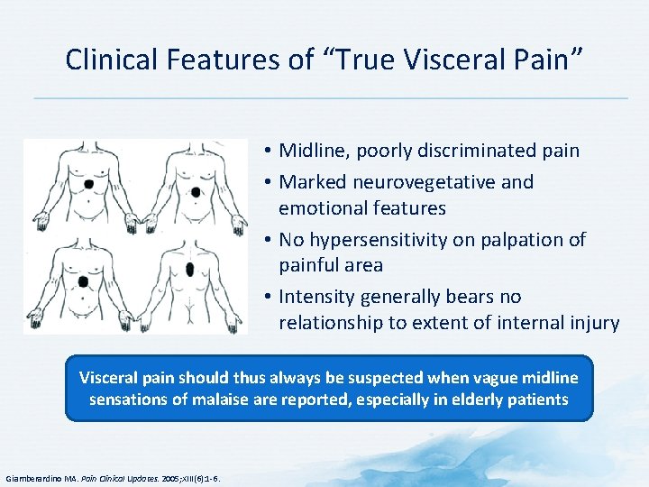 Clinical Features of “True Visceral Pain” • Midline, poorly discriminated pain • Marked neurovegetative