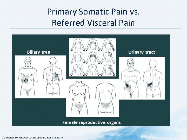 Primary Somatic Pain vs. Referred Visceral Pain Heart Giamberardino MA. Pain Clinical Updates. 2005;