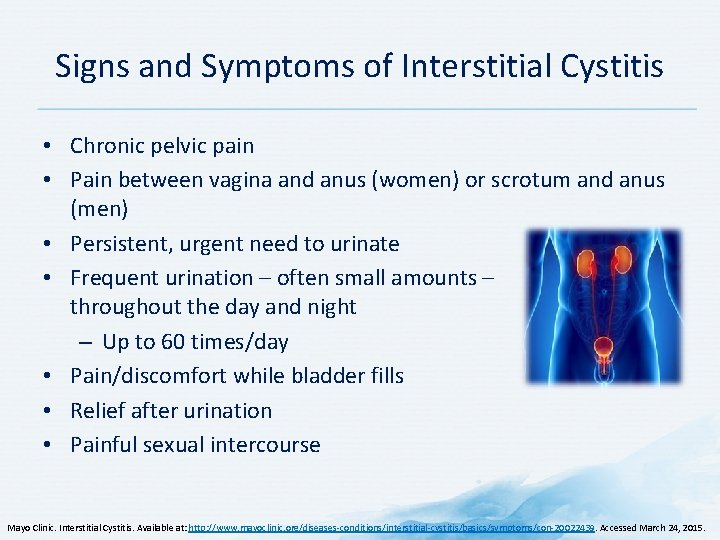 Signs and Symptoms of Interstitial Cystitis • Chronic pelvic pain • Pain between vagina