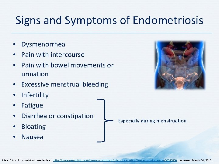 Signs and Symptoms of Endometriosis • Dysmenorrhea • Pain with intercourse • Pain with