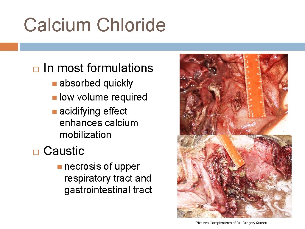 Calcium Chloride In most formulations absorbed quickly low volume required acidifying effect enhances calcium