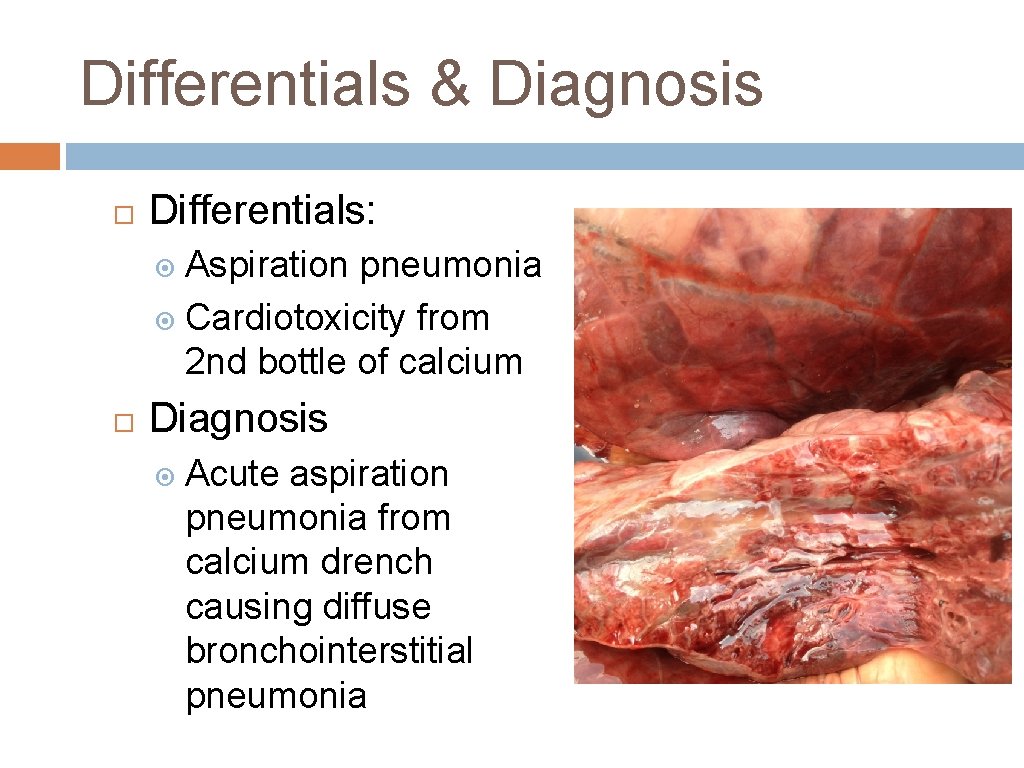 Differentials & Diagnosis Differentials: Aspiration pneumonia Cardiotoxicity from 2 nd bottle of calcium Diagnosis