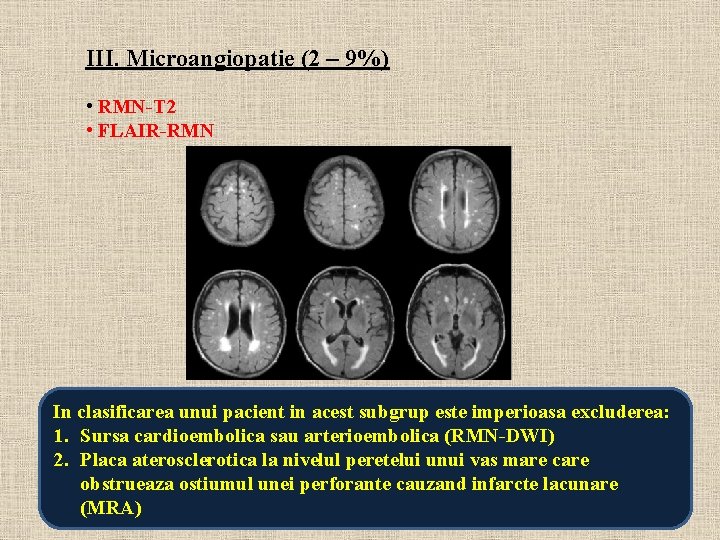 Simptome cerebrale de microangiopatie, cauze, tratament