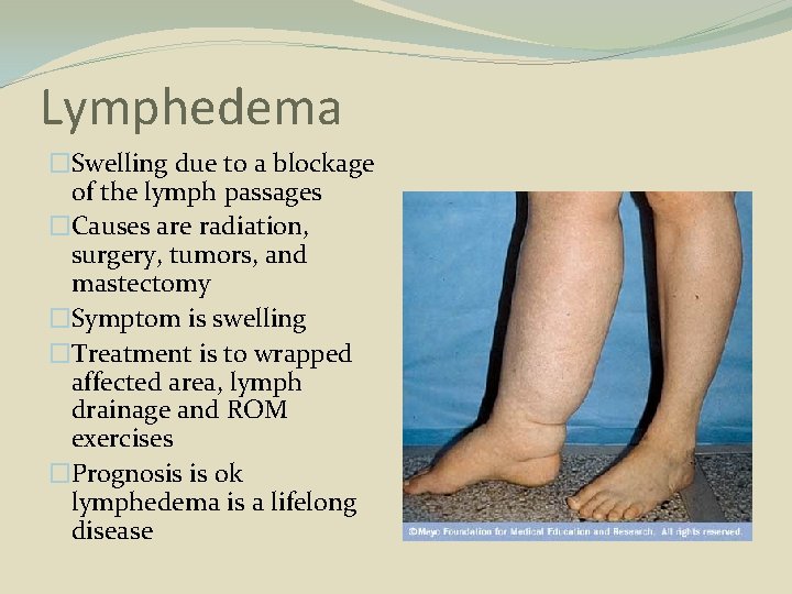 Lymphedema �Swelling due to a blockage of the lymph passages �Causes are radiation, surgery,