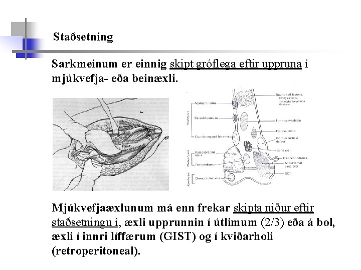 Staðsetning Sarkmeinum er einnig skipt gróflega eftir uppruna í mjúkvefja- eða beinæxli. Mjúkvefjaæxlunum má