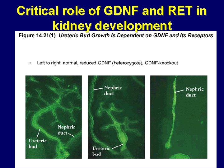 Critical role of GDNF and RET in kidney development Critical role of GDNF and RET in kidney development
