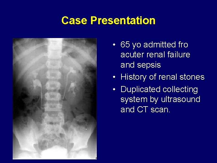 Case Presentation • 65 yo admitted fro acuter renal failure and sepsis • History Case Presentation • 65 yo admitted fro acuter renal failure and sepsis • History