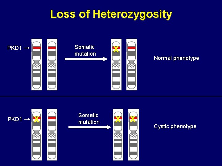 Loss of Heterozygosity Somatic mutation PKD 1 X Somatic mutation X Normal phenotype X Loss of Heterozygosity Somatic mutation PKD 1 X Somatic mutation X Normal phenotype X