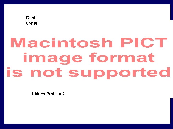 Dupl ureter Kidney Problem? Dupl ureter Kidney Problem?