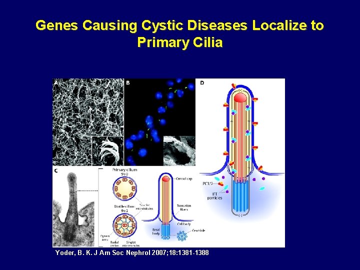 Genes Causing Cystic Diseases Localize to Primary Cilia Yoder, B. K. J Am Soc Genes Causing Cystic Diseases Localize to Primary Cilia Yoder, B. K. J Am Soc