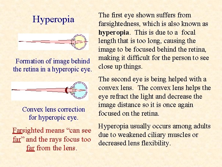 The first eye shown suffers from farsightedness, which is also known as hyperopia. This
