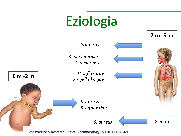 Eziologia 2 m -5 aa S. aureus S. pneumoniae S. pyogenes 0 m -2