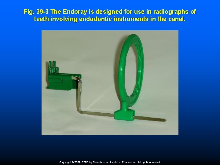 Fig. 39 -3 The Endoray is designed for use in radiographs of teeth involving