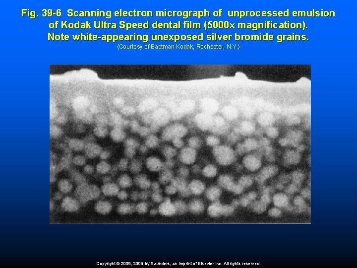 Fig. 39 -6 Scanning electron micrograph of unprocessed emulsion of Kodak Ultra Speed dental