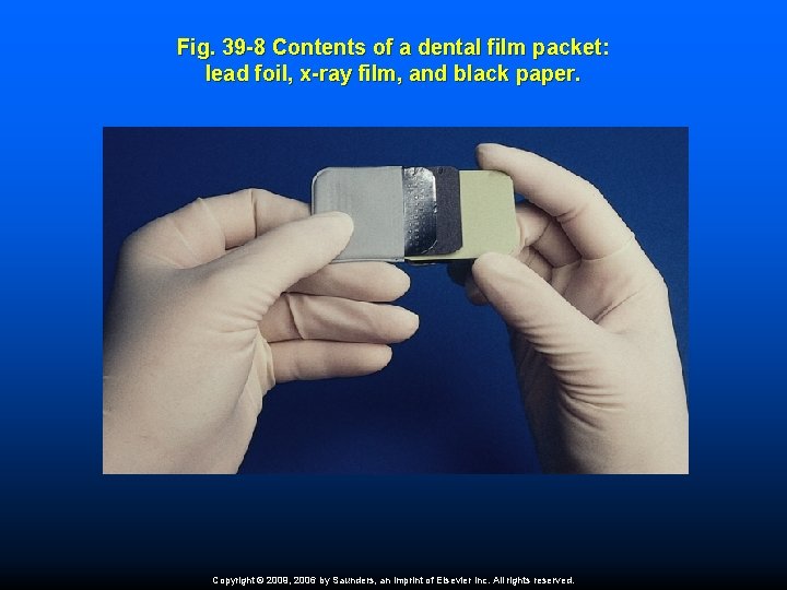 Fig. 39 -8 Contents of a dental film packet: lead foil, x-ray film, and