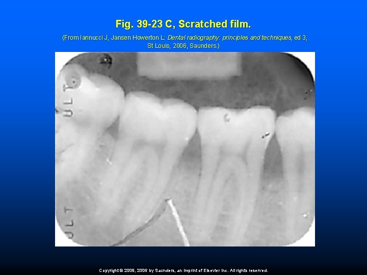 Fig. 39 -23 C, Scratched film. (From Iannucci J, Jansen Howerton L: Dental radiography: