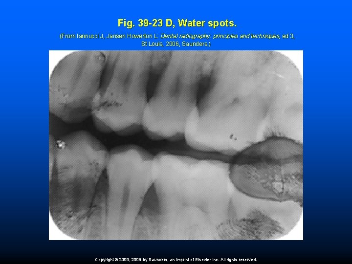 Fig. 39 -23 D, Water spots. (From Iannucci J, Jansen Howerton L: Dental radiography: