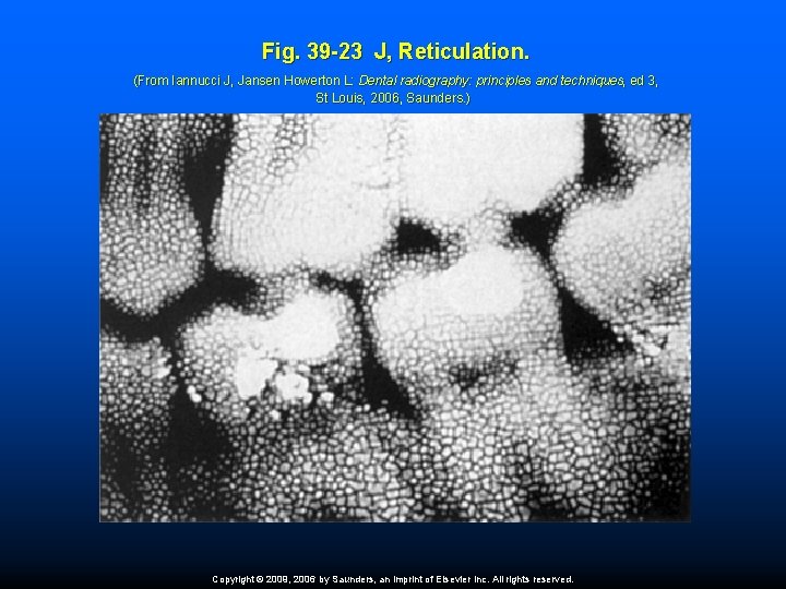Fig. 39 -23 J, Reticulation. (From Iannucci J, Jansen Howerton L: Dental radiography: principles