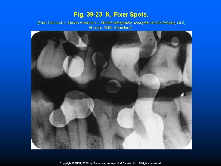 Fig. 39 -23 K, Fixer Spots. (From Iannucci J, Jansen Howerton L: Dental radiography: