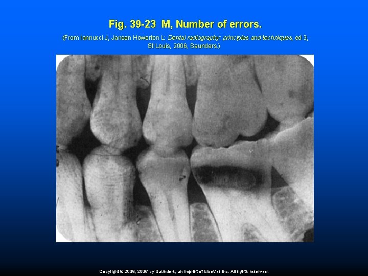 Fig. 39 -23 M, Number of errors. (From Iannucci J, Jansen Howerton L: Dental