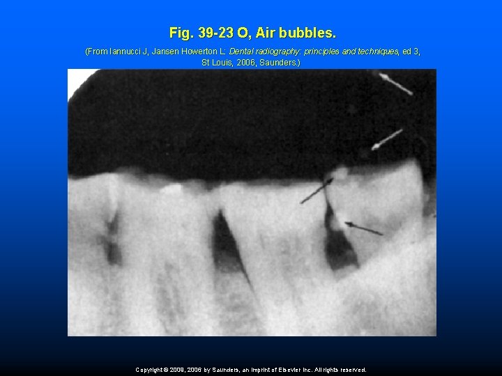 Fig. 39 -23 O, Air bubbles. (From Iannucci J, Jansen Howerton L: Dental radiography: