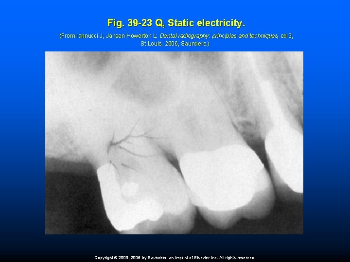 Fig. 39 -23 Q, Static electricity. (From Iannucci J, Jansen Howerton L: Dental radiography: