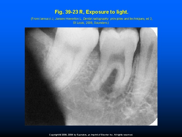 Fig. 39 -23 R, Exposure to light. (From Iannucci J, Jansen Howerton L: Dental