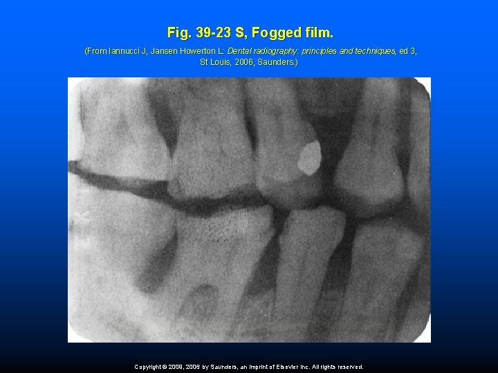 Fig. 39 -23 S, Fogged film. (From Iannucci J, Jansen Howerton L: Dental radiography: