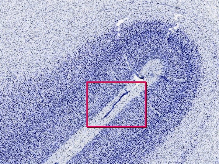 Monkey coronal section 4 