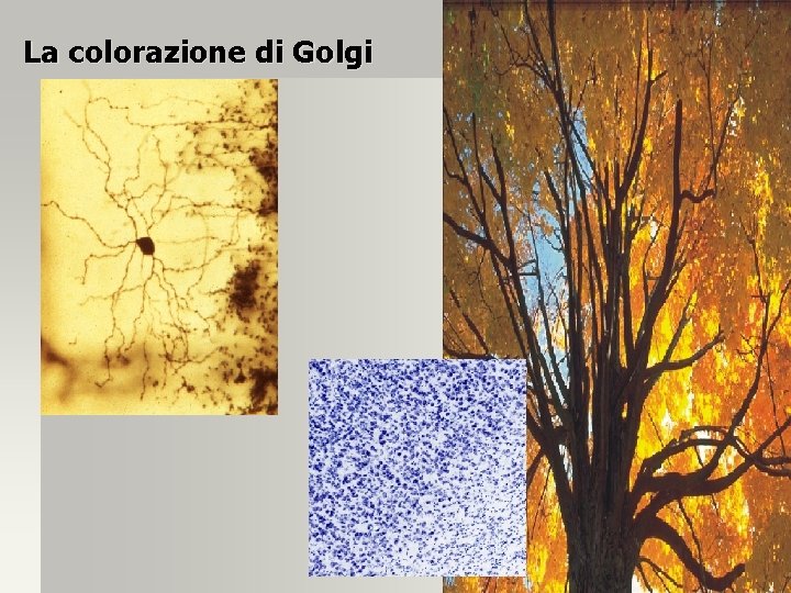 La colorazione di Golgi 