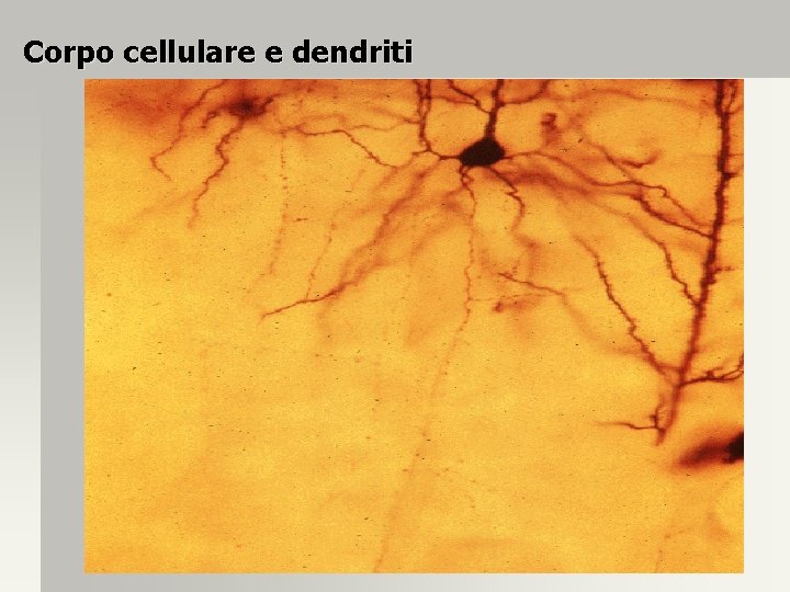 Corpo cellulare e dendriti 