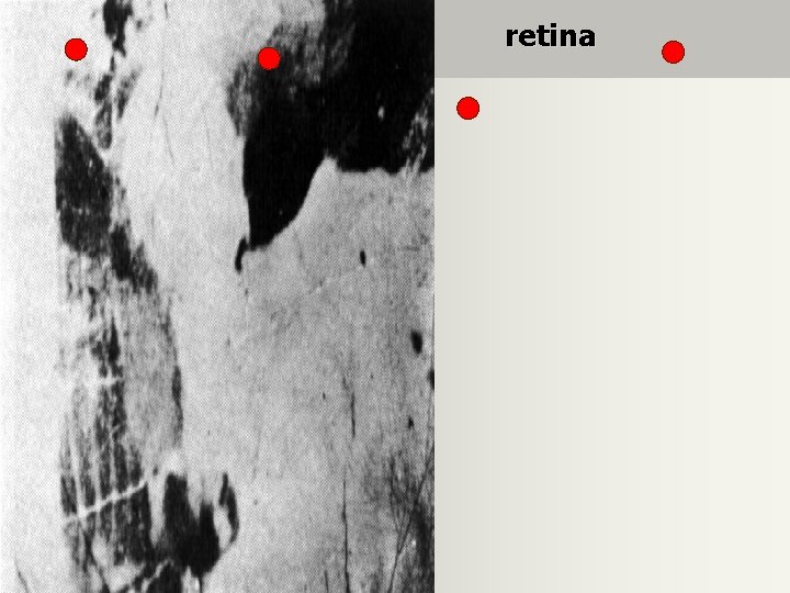 retina 