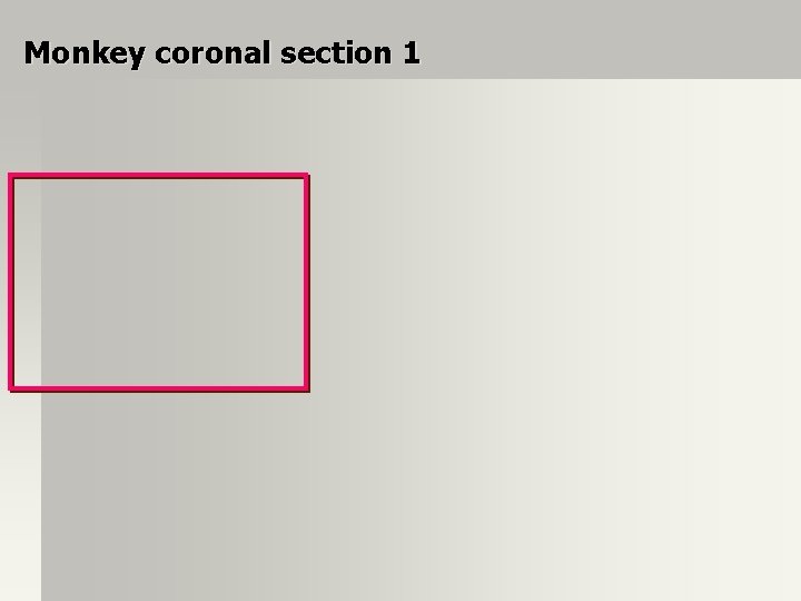 Monkey coronal section 1 