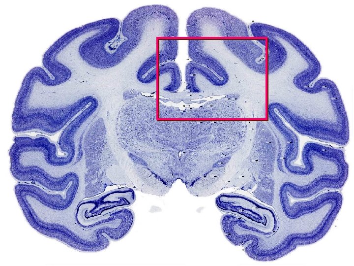 Monkey coronal section 2 