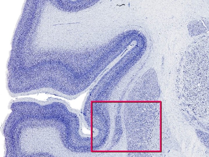 Monkey coronal section 3 