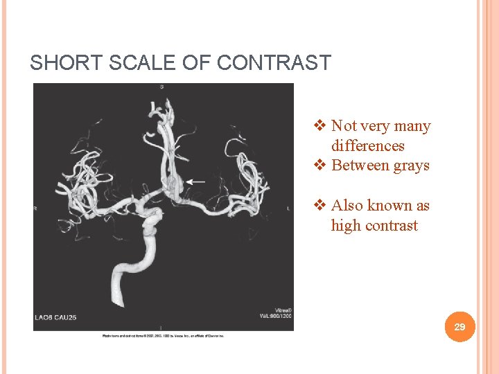 SHORT SCALE OF CONTRAST v Not very many differences v Between grays v Also