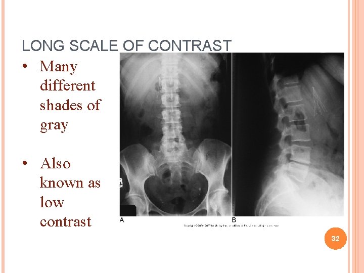 LONG SCALE OF CONTRAST • Many different shades of gray • Also known as