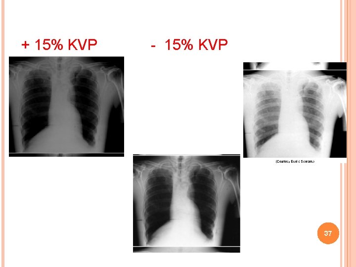 + 15% KVP - 15% KVP 37 