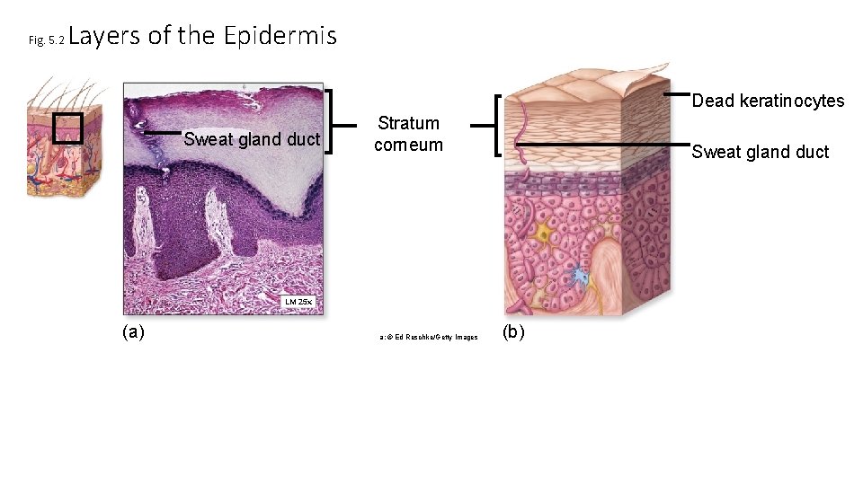 Fig. 5. 2 Layers of the Epidermis Dead keratinocytes Sweat gland duct Stratum corneum