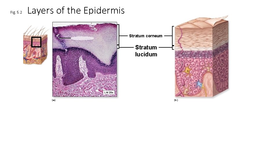 Fig. 5. 2 Layers of the Epidermis Stratum corneum Stratum lucidum LM 25 x