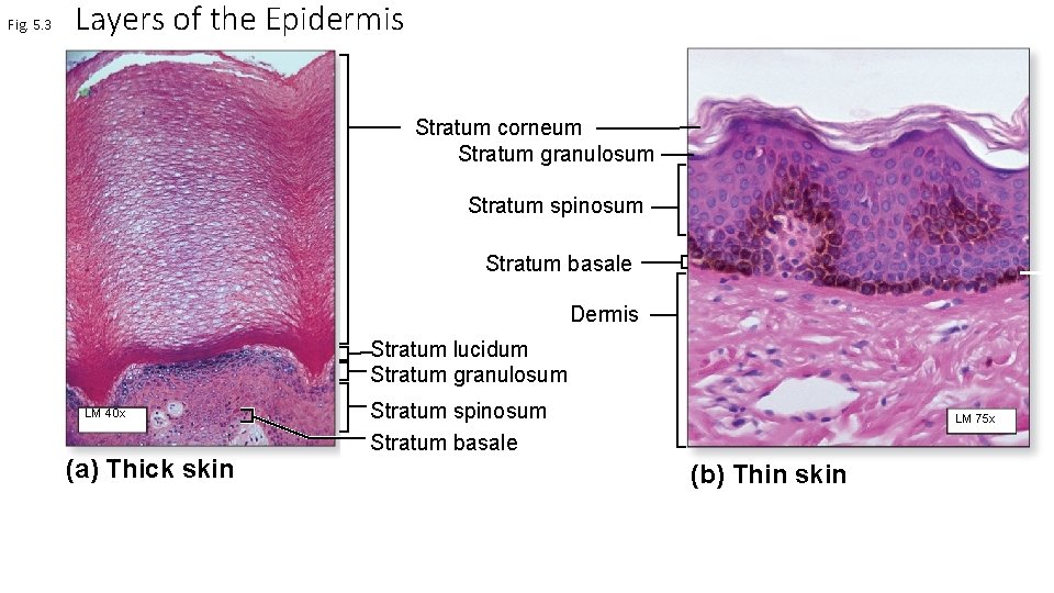 Fig. 5. 3 Layers of the Epidermis Stratum corneum Stratum granulosum Stratum spinosum Stratum