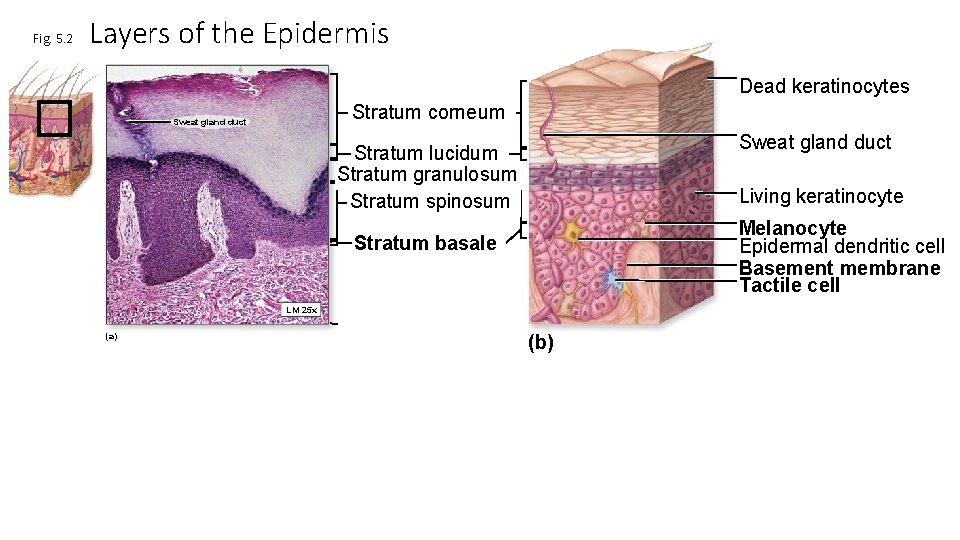 Fig. 5. 2 Layers of the Epidermis Dead keratinocytes Stratum corneum Sweat gland duct
