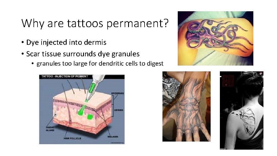 Why are tattoos permanent? • Dye injected into dermis • Scar tissue surrounds dye