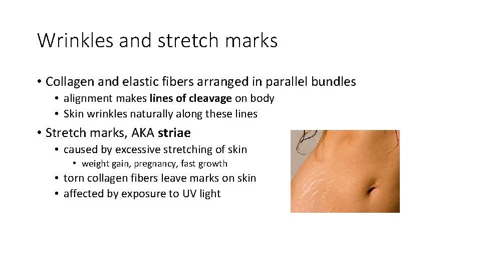 Wrinkles and stretch marks • Collagen and elastic fibers arranged in parallel bundles •
