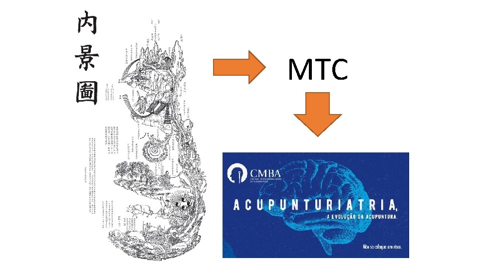 MTC MTC