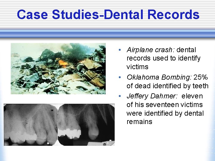 Case Studies-Dental Records • Airplane crash: dental records used to identify victims • Oklahoma