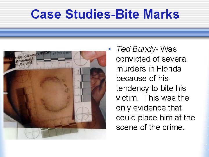 Case Studies-Bite Marks • Ted Bundy- Was convicted of several murders in Florida because